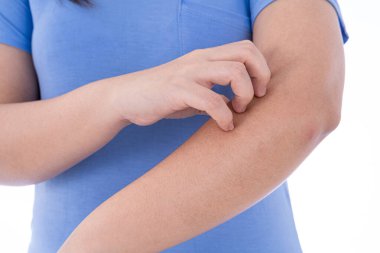 İzole edilmiş beyaz arka planda kolunu kaşıyan bir kadın. Reklam konsepti için tıbbi ve sağlık hizmeti.