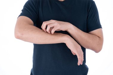 İzole edilmiş beyaz arka planda kolunu kaşıyan bir erkek. Reklam konsepti için tıbbi ve sağlık hizmeti.