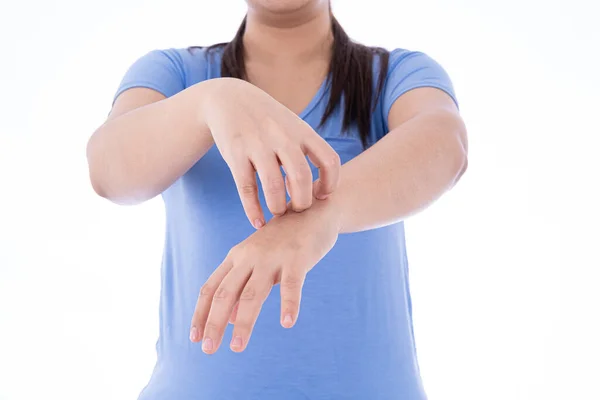 Donna Che Gratta Mano Uno Sfondo Bianco Isolato Medicina Sanità — Foto Stock