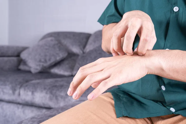 Young Man Scratching His Hand While Sitting Sofa Home Healthcare — Stock Photo, Image