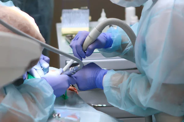 Стоматолог Проводить Операцію Лікування Глибокого Карієсу Під Загальною Анестезією Дитини — стокове фото