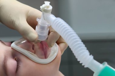 Ameliyattan önce küçük bir çocuğa anestezi uygulaması. Çocuğun yüzünde solunum maskesi. Boşluğu kopyala.
