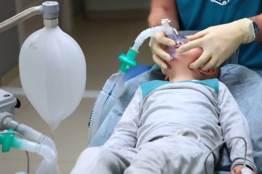 Anestezi altında küçük bir çocuğun tanıtımı. Çoklu bakterileri çıkarmak için diş cerrahisi hazırlığı. Bebek dişlerinin tedavisi. Ciğerlerin yapay havalandırma cihazı. Uzayı kopyala..