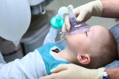 Çocuk genel anestezi altında. Bebek dişlerinin tedavisi. Ciğerlerin yapay havalandırma cihazı. Uzayı kopyala..
