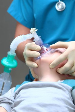 Küçük bir çocuğu diş ameliyatına hazırlıyorum. Genel anestezi. Çoklu bebek dişi tedavisinde kullanılıyor. Ciğerlerde yapay havalandırma cihazı. Uzayı kopyala Dikey fotoğraf.