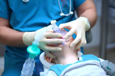 Anestezi uzmanı çocuğun yüzünde solunum maskesi tutuyor. Diş ameliyatına hazırlık. Genel anestezi. Çoklu bebek dişi tedavisinde kullanılıyor. Ciğerlerde yapay havalandırma cihazı. Boşluğu kopyala.