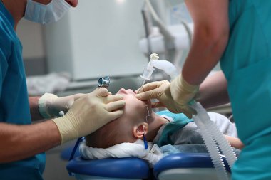 Bir anestezi uzmanı küçük bir çocuğun nefes borusuna bir tüp yerleştirir. Genel anestezi altında operasyon. Ciğerlerde yapay havalandırma cihazı. Fotoğraf ameliyathanede..