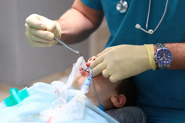 Das Ende Der Operation Das Kind Wird Aus Der Narkose — Stockfoto