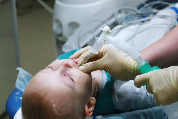 呼吸管を持つ小さな男の子 全身麻酔下での手術 肺の人工換気装置 トップ表示 — ストック写真
