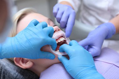 Bir dişçi ve asistan küçük bir çocuk için retraktör yerleştirir. Hastalar için teselli. Sağlık ve hastalık önleme kavramı. Pediatrik dişçilik. Eller koruyucu eldivenlerde..