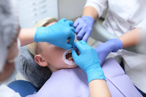 Dentista Assistente Installano Riavvolgitore Nella Bocca Bambino Comfort Pazienti Concetto — Foto Stock