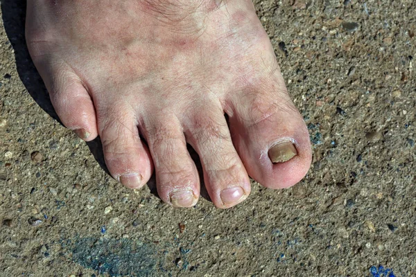 Macro Male Naked Foot Concrete Sunlight — Stock Photo, Image