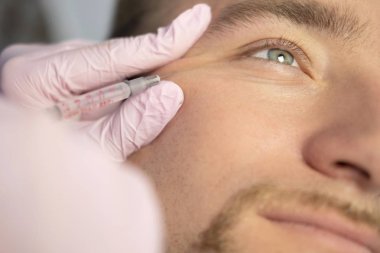Güzellik closeup ana yapıyor enjeksiyon In genç erkek hasta Face. Güzellik yordamı kullanarak dolgu enjeksiyonları almak adam. Kozmetik ve Güzellik yüz enjeksiyon kavramı