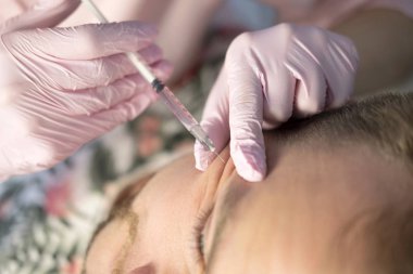 Güzellik closeup ana yapıyor enjeksiyon In genç erkek hasta Face. Güzellik yordamı kullanarak dolgu enjeksiyonları almak adam. Kozmetik ve Güzellik yüz enjeksiyon kavramı