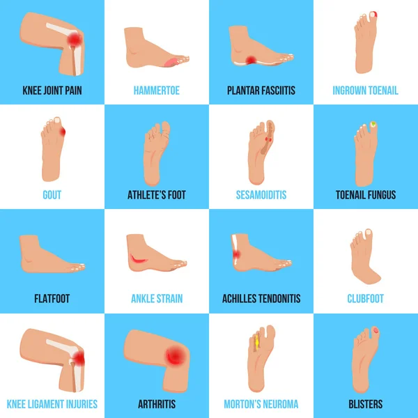 Fußprobleme flache Symbole gesetzt — Stockvektor