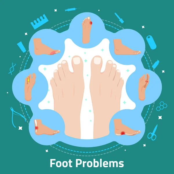 Foot Problems Flat Composition — Stock Vector