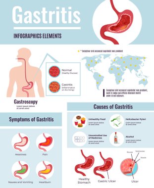 Gastrit Infographic Poster 
