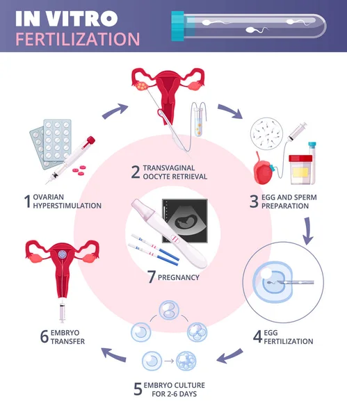 Flat In Vitro Fertilization IVF  Infographics — Stock Vector
