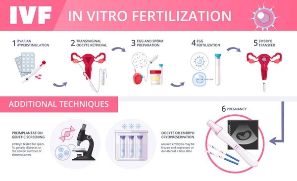 In Vitro Fertilization IVF Flat Infographics — Stock Vector