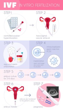 İn vitro fertilizasyon Infographics içinde