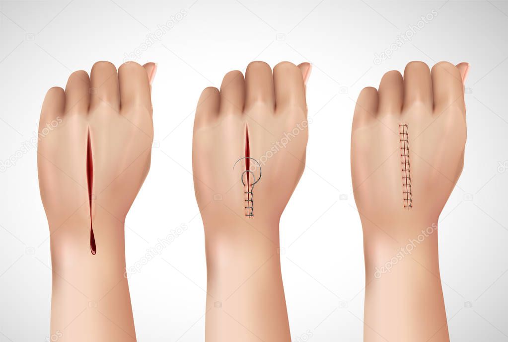 Surgical Stitching Hands Composition