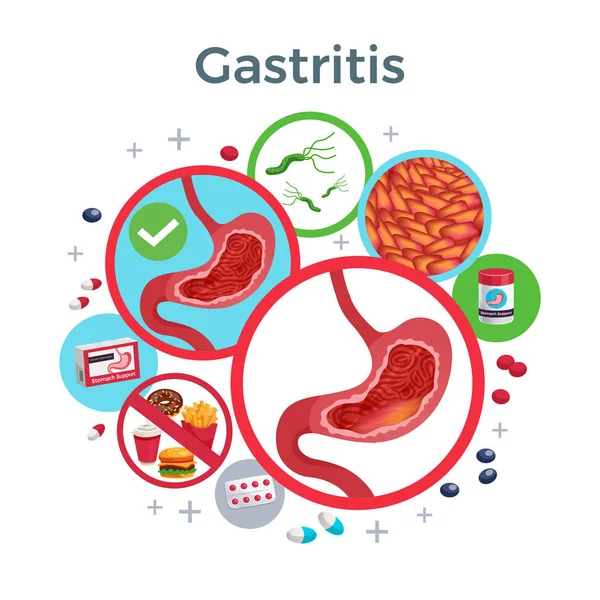 Gastritis Composición plana — Archivo Imágenes Vectoriales