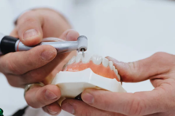 Ένας Οδοντοτεχνίτης Επεξεργάζεται Γύψο Από Γνάθο Του Ασθενούς — Φωτογραφία Αρχείου