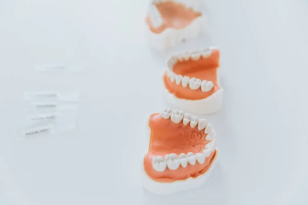 Modelli Plastici Della Mandibola Protesi Odontoiatria Chirurgia Maxillo Facciale Trovano — Foto Stock