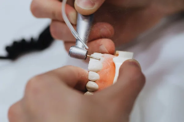 Technik Dentystyczny Przetwarza Odlew Szczęki Pacjenta — Zdjęcie stockowe
