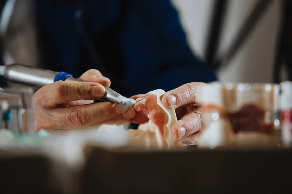 Technik Dentystyczny Przetwarza Odlew Szczęki Pacjenta — Zdjęcie stockowe