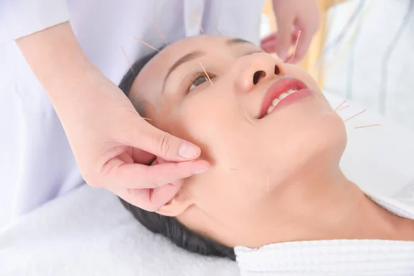 Krásná Asijská Žena Dostává Ošetření Obličejové Akupunktury Klinice Alternativní Medicína — Stock fotografie