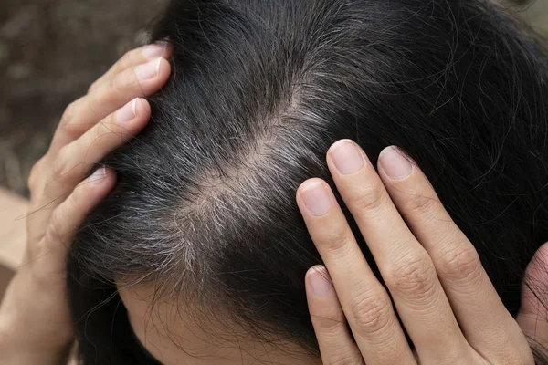 Mujer Joven Muestra Sus Raíces Pelo Gris — Foto de Stock