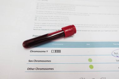 Laboratuvarda kromozom testi için kan.