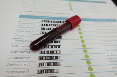 Laboratuvarda kromozom testi için kan.