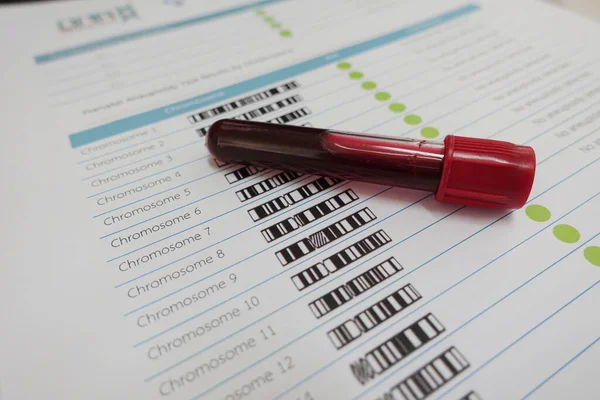 Laboratuvarda kromozom testi için kan.