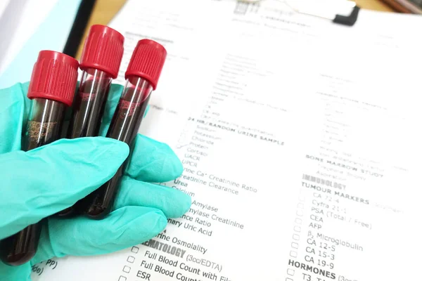 医院实验室的血液检测 — 图库照片