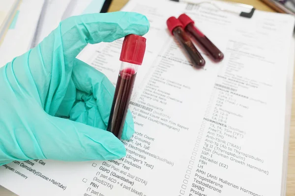 Krevní Testy Laboratoři Nemocnici Stock Fotografie