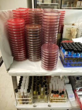 Kan agarlı petri kapları, çikolata agar, Maconkey agar, et suyu tüpleri.