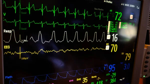 EKG, pulzus, vérnyomás és légzés Intenzív monitor képernyő — Stock Fotó