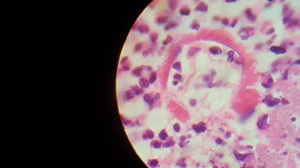 Coccidioides σφαιρίδιο ιμίτιδας που καταστρέφεται στον πλακούντα — Φωτογραφία Αρχείου