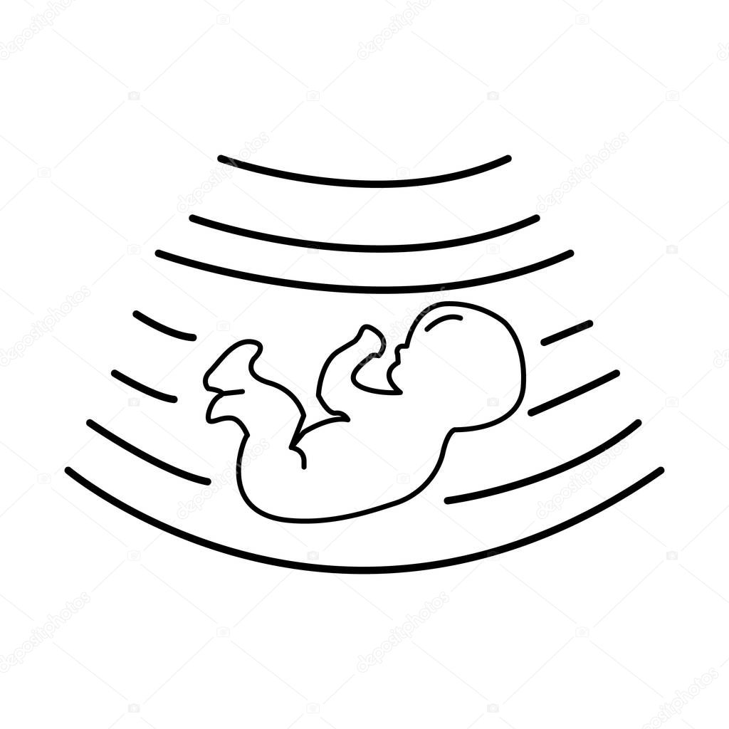 Baby ultrasound. Line vector illustration. Isolated. Diagnostic sonography vs ultrasonography imaging for medical apps and websites.