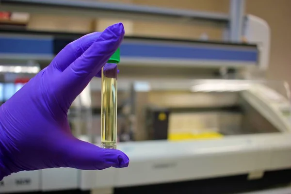 Uyuşturucu tespiti ve doping için idrar testi tüpünün ayrıntıları