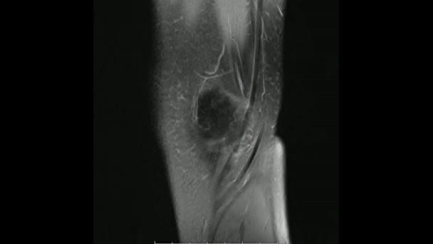 膝关节矢状质子密度成像 Mri膝关节 的磁共振成像显示膝关节解剖 — 图库视频影像