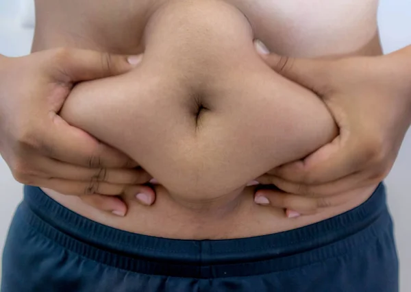 Overweight Asian obese men. Fat man.