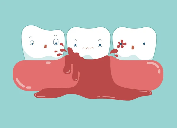 Zum Entfernen Von Karies Zähnen Und Zahnkonzept Des Zahnes — Stockvektor