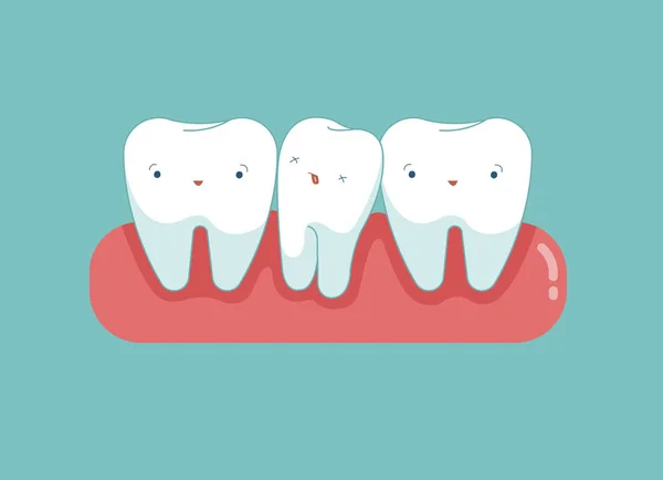 Diente Abarrotado Concepto Dibujos Animados Dentales — Archivo Imágenes Vectoriales