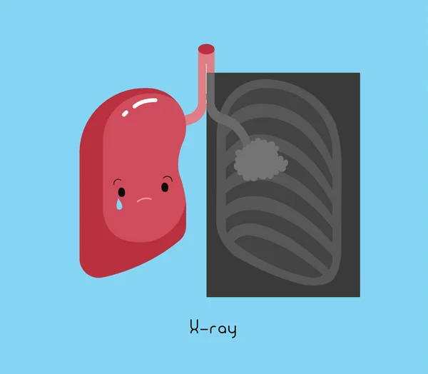Ray Raka Płuc Człowieka Kreskówka Wektor — Wektor stockowy