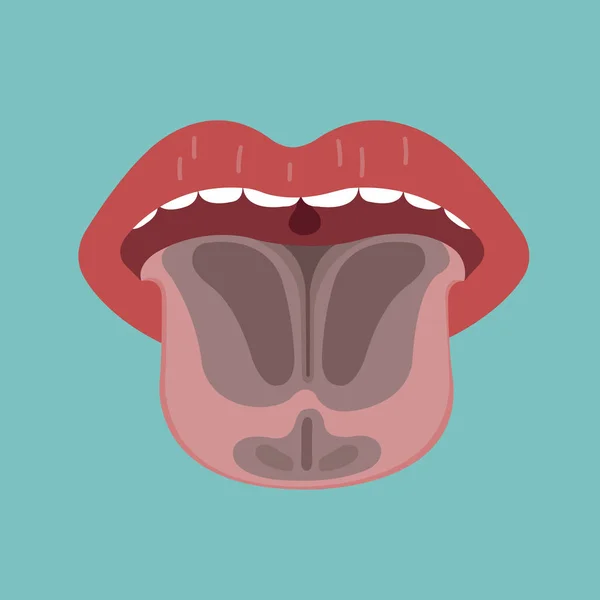 Tongue Disease Vector Organ Concept — Stock Vector