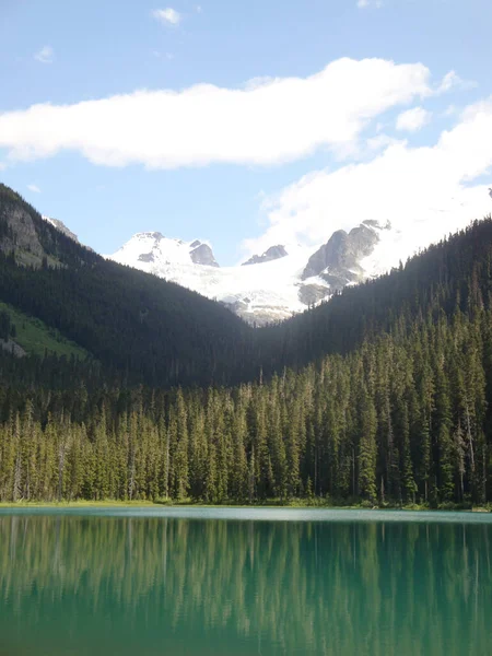 Moraine Λίμνη Στον Καναδά Μια Ηλιόλουστη Μέρα Του Καλοκαιριού Χιονισμένα — Φωτογραφία Αρχείου