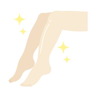 Ayak kıllarını aldırma illüstrasyonu